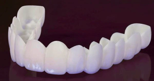 Lente de Contato Dental Removível Inferior e Superior - Image 6