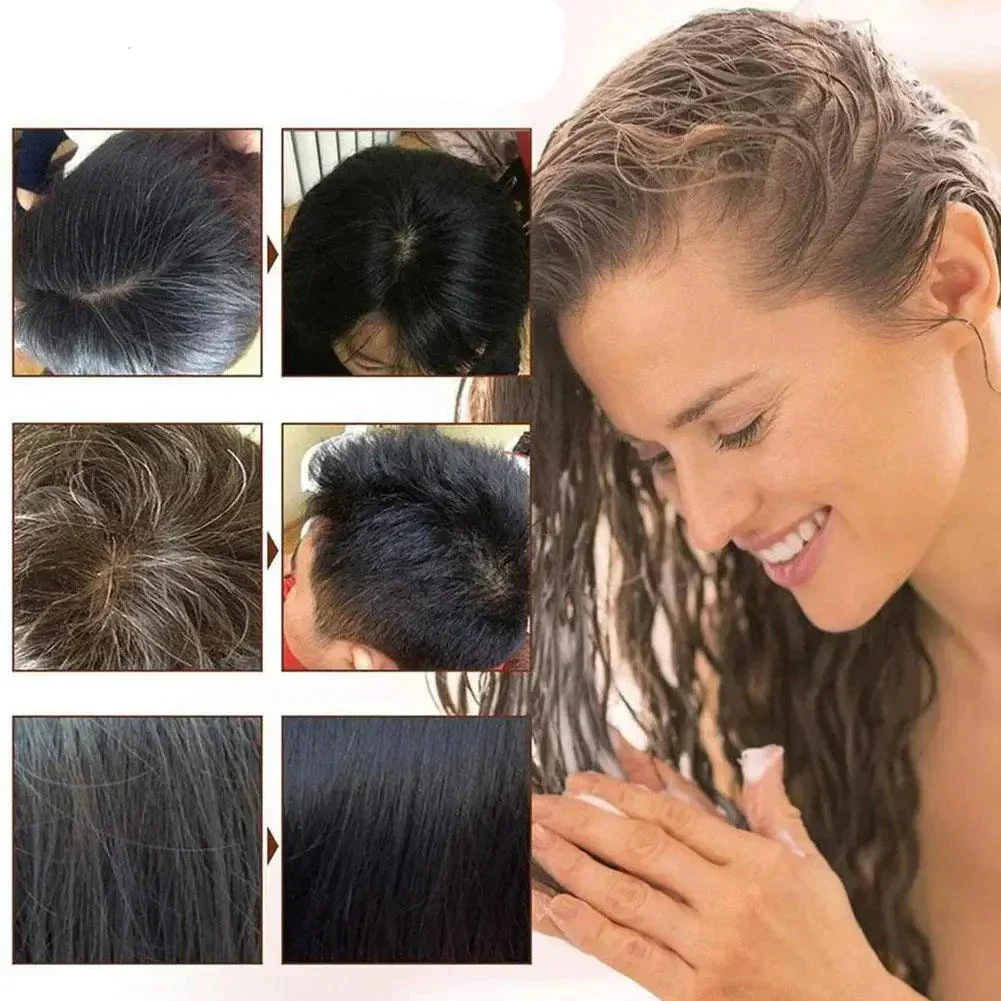 Shampoo Turbo Color Hair - PROMOÇÃO DA 2 UNIDADE SOMENTE HOJE - Image 7